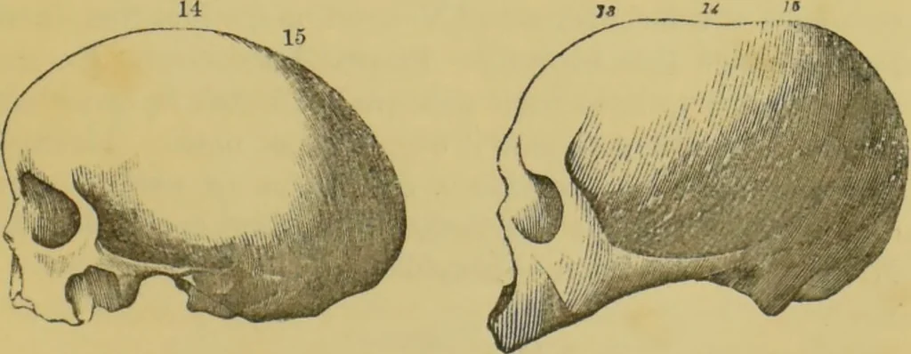 An illustration from Elements of phrenology / by George Combe., 1862, leaf 109