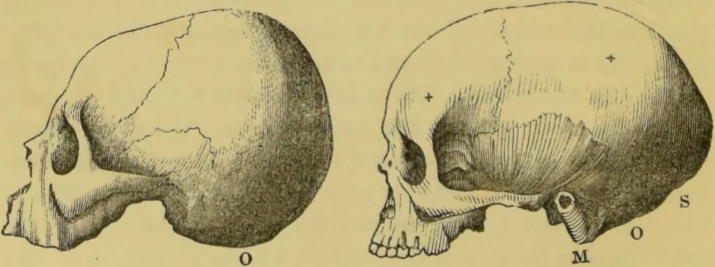 An illustration from Elements of phrenology / by George Combe., 1862, leaf 76