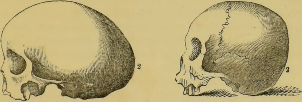 An illustration from Elements of phrenology / by George Combe., 1862, leaf 79