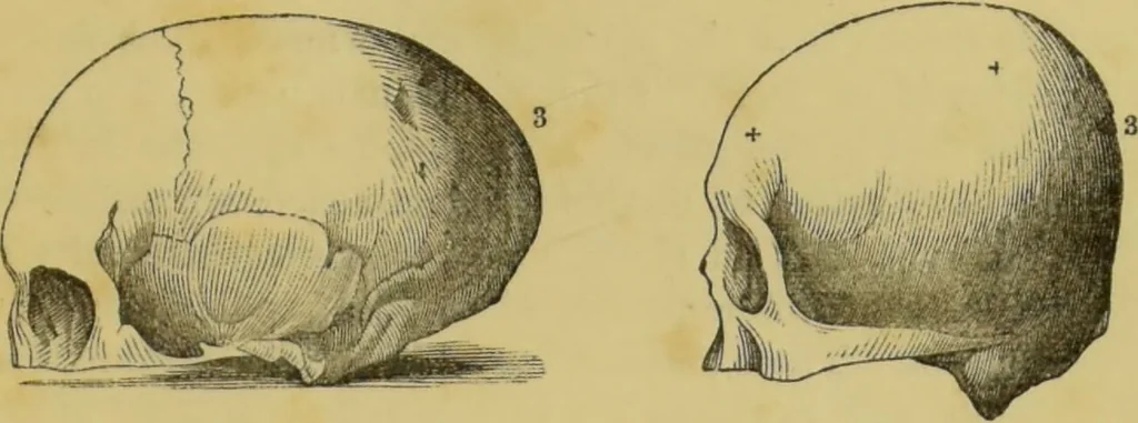 An illustration from Elements of phrenology / by George Combe., 1862, leaf 81