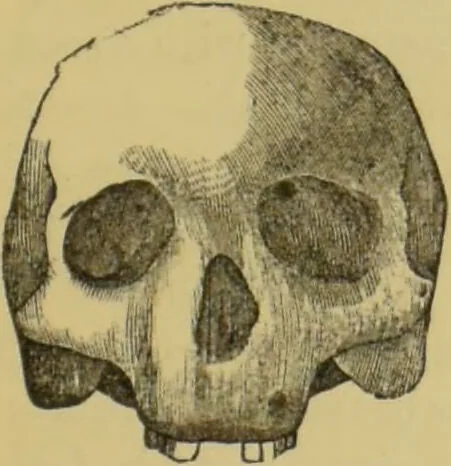 An illustration from Elements of phrenology / by George Combe., 1862, leaf 87