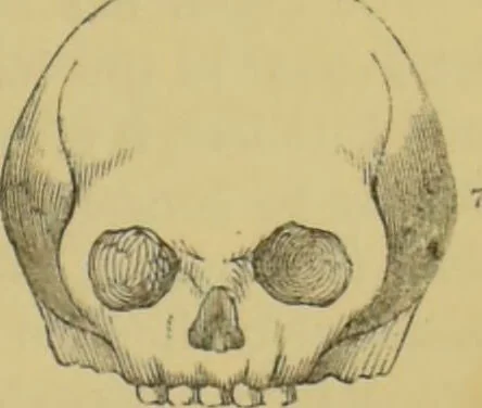 An illustration from Elements of phrenology / by George Combe., 1862, leaf 91