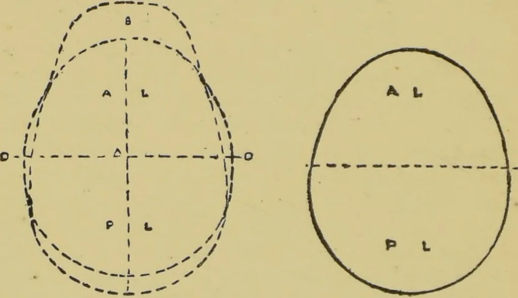 An illustration from How to read heads, or, Practical physiognomy made easy : the science and art of reading character briefly outlined, illustrated, and explained / by James Coates., 1890, leaf 46
