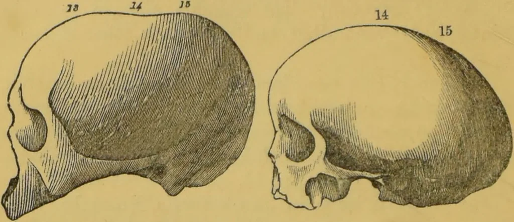 An illustration from Elements of phrenology / by George Combe., 1855, leaf 114