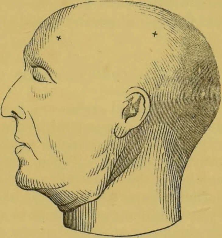 An illustration from Elements of phrenology / by George Combe., 1855, leaf 217