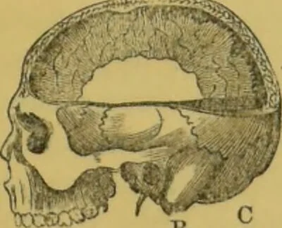 An illustration from Elements of phrenology / by George Combe., 1855, leaf 65