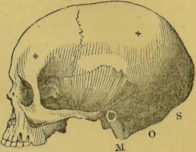 An illustration from Elements of phrenology / by George Combe., 1855, leaf 79