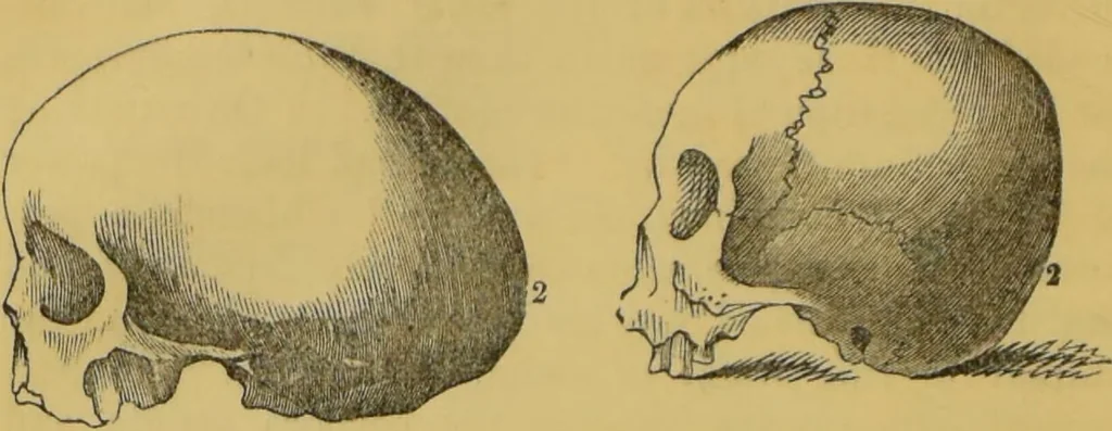 An illustration from Elements of phrenology / by George Combe., 1855, leaf 82