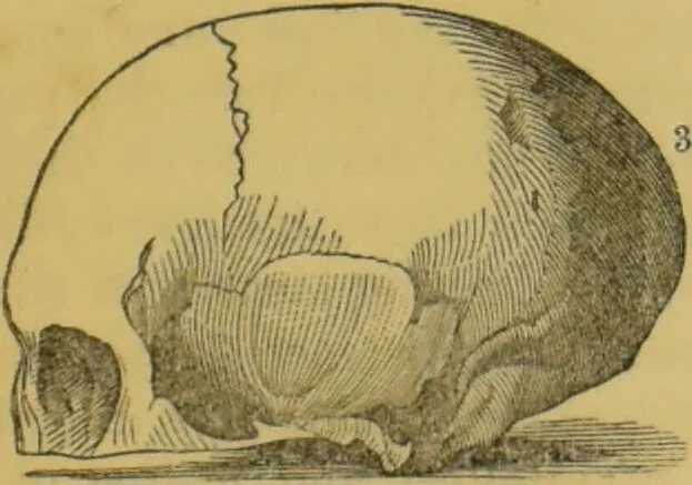 An illustration from Elements of phrenology / by George Combe., 1855, leaf 83