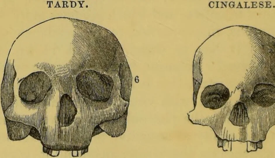 An illustration from Elements of phrenology / by George Combe., 1855, leaf 90