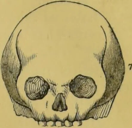 An illustration from Elements of phrenology / by George Combe., 1855, leaf 95