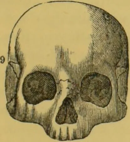 An illustration from Elements of phrenology / by George Combe., 1855, leaf 99