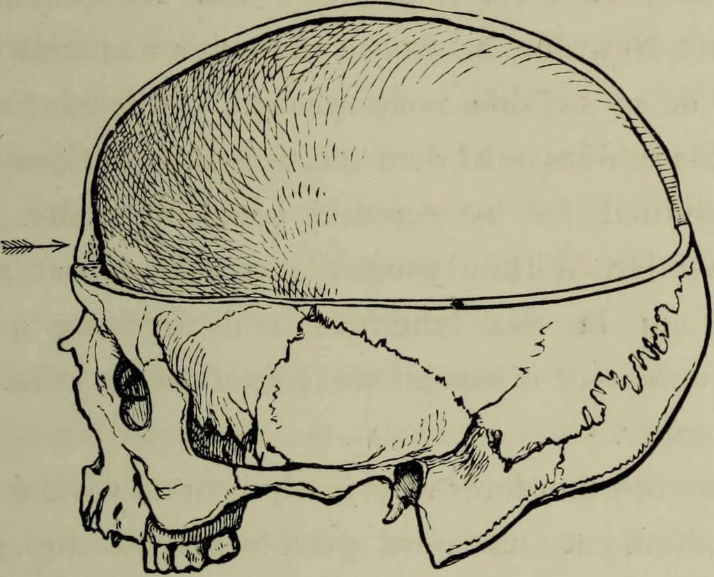 An illustration from Phrenology vindicated : being a reply to the article by Dr Andrew Wilson, entitled "The old phrenology and the new", which appeared in "The gentleman's magazine", January, 1879 / by A.L. Vago., 1879, leaf 45