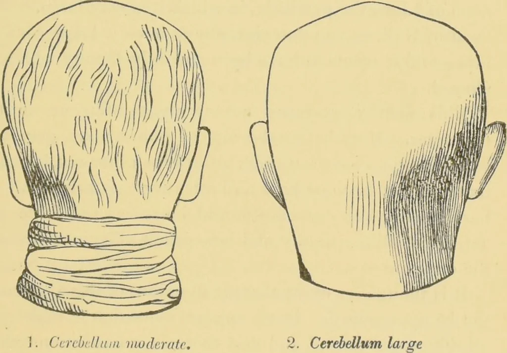 An illustration from Lectures on phrenology / by George Combe ; including its application to the present and prospective condition of the United States, with notes, an introductory essay, and a historical sketch by Andrew Boardman., 1889, leaf 145