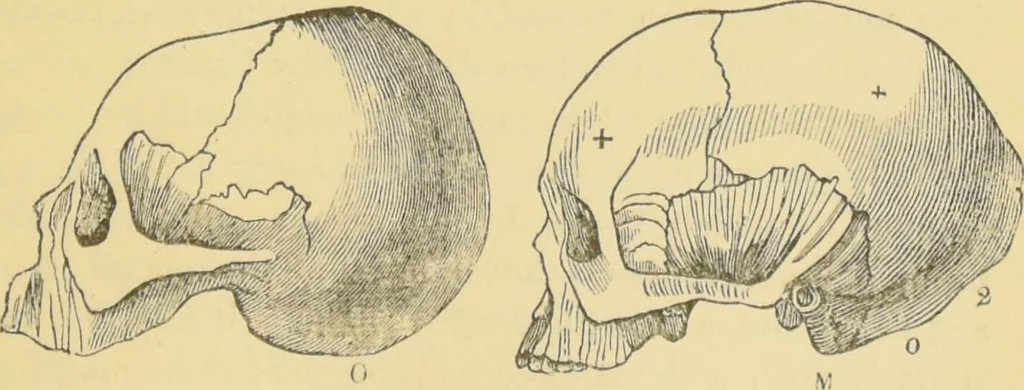 An illustration from Lectures on phrenology / by George Combe ; including its application to the present and prospective condition of the United States, with notes, an introductory essay, and a historical sketch by Andrew Boardman., 1889, leaf 145