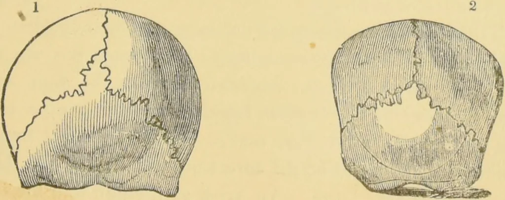 An illustration from Lectures on phrenology / by George Combe ; including its application to the present and prospective condition of the United States, with notes, an introductory essay, and a historical sketch by Andrew Boardman., 1889, leaf 157