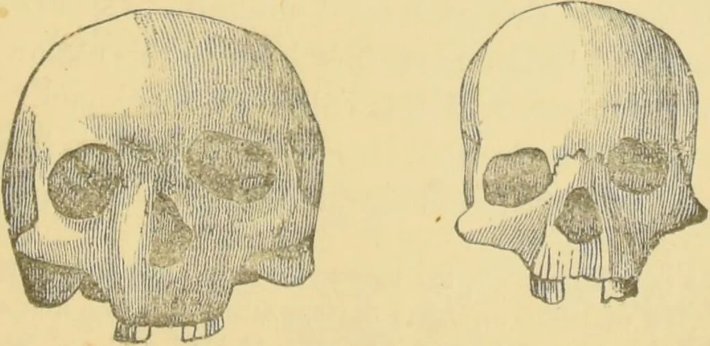 An illustration from Lectures on phrenology / by George Combe ; including its application to the present and prospective condition of the United States, with notes, an introductory essay, and a historical sketch by Andrew Boardman., 1889, leaf 163