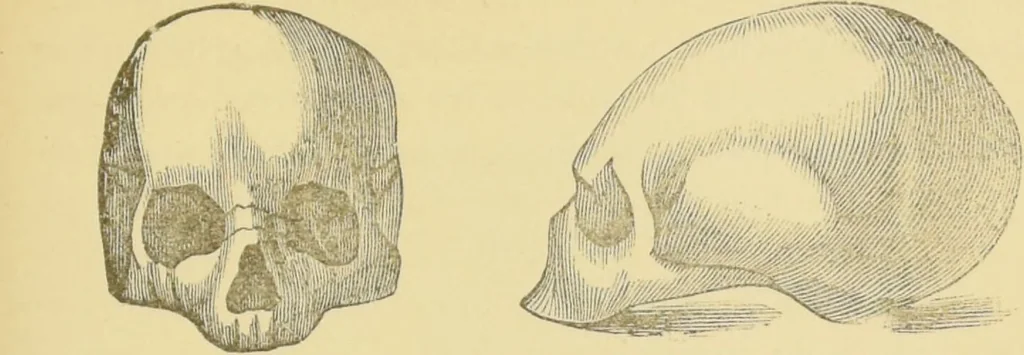 An illustration from Lectures on phrenology / by George Combe ; including its application to the present and prospective condition of the United States, with notes, an introductory essay, and a historical sketch by Andrew Boardman., 1889, leaf 181