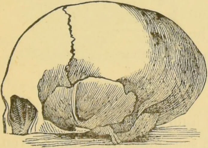 An illustration from Lectures on phrenology / by George Combe ; including its application to the present and prospective condition of the United States, with notes, an introductory essay, and a historical sketch by Andrew Boardman., 1889, leaf 39