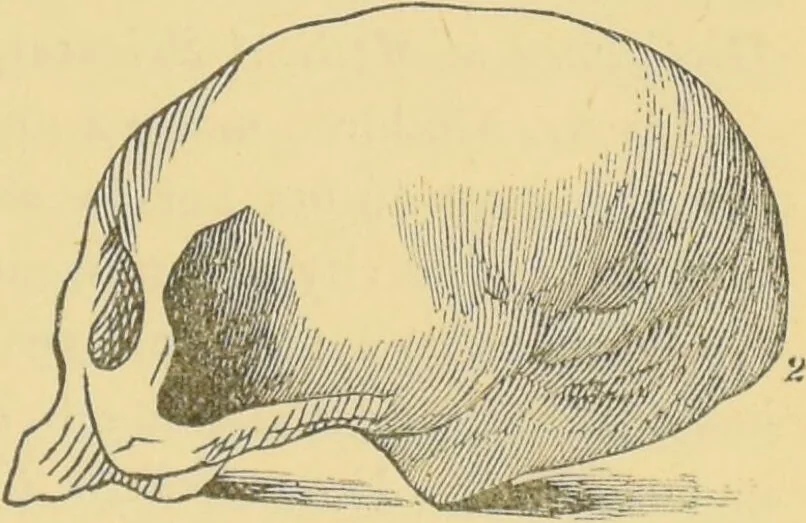An illustration from Lectures on phrenology / by George Combe ; including its application to the present and prospective condition of the United States, with notes, an introductory essay, and a historical sketch by Andrew Boardman., 1889, leaf 47