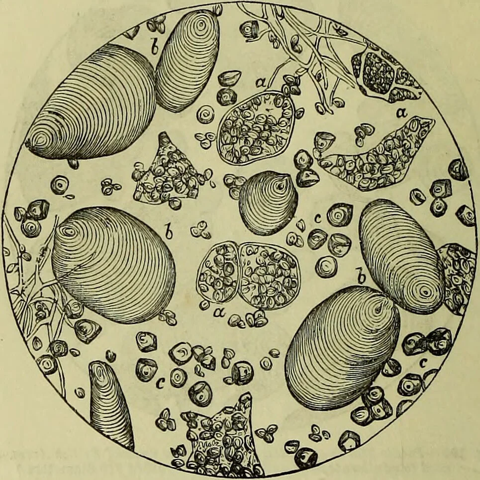 An illustration from The microscope : its history, construction, and application, being a familiar introduction to the use of the instrument, and the study of microscopical science / by Jabez Hogg ; with upwards of five hundred engravings, and coloured illustrations by Tuffen West., 1883, leaf 376