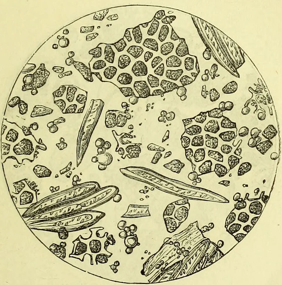 An illustration from The microscope : its history, construction, and application, being a familiar introduction to the use of the instrument, and the study of microscopical science / by Jabez Hogg ; with upwards of five hundred engravings, and coloured illustrations by Tuffen West., 1883, leaf 377