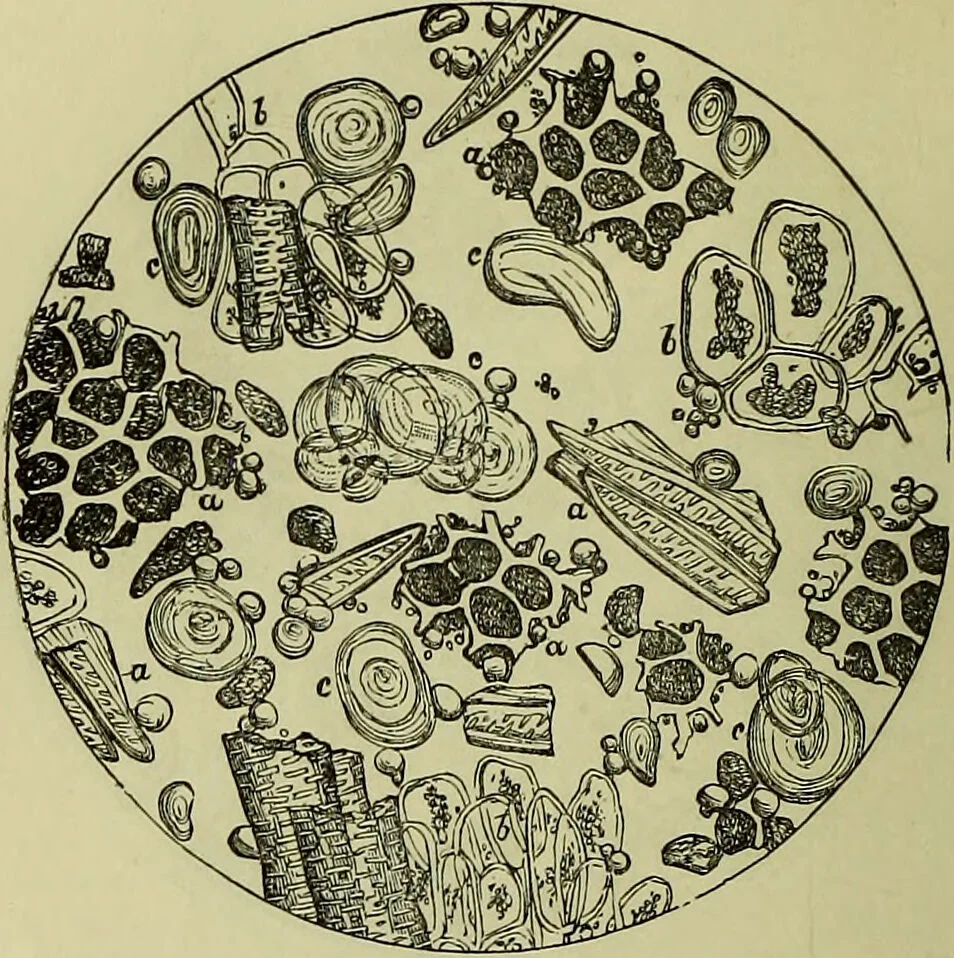 An illustration from The microscope : its history, construction, and application, being a familiar introduction to the use of the instrument, and the study of microscopical science / by Jabez Hogg ; with upwards of five hundred engravings, and coloured illustrations by Tuffen West., 1883, leaf 378