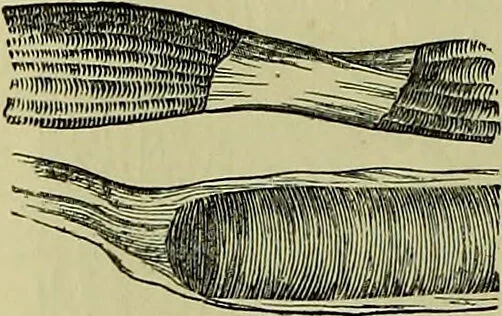 An illustration from The microscope : its history, construction, and application, being a familiar introduction to the use of the instrument, and the study of microscopical science / by Jabez Hogg ; with upwards of five hundred engravings, and coloured illustrations by Tuffen West., 1883, leaf 736