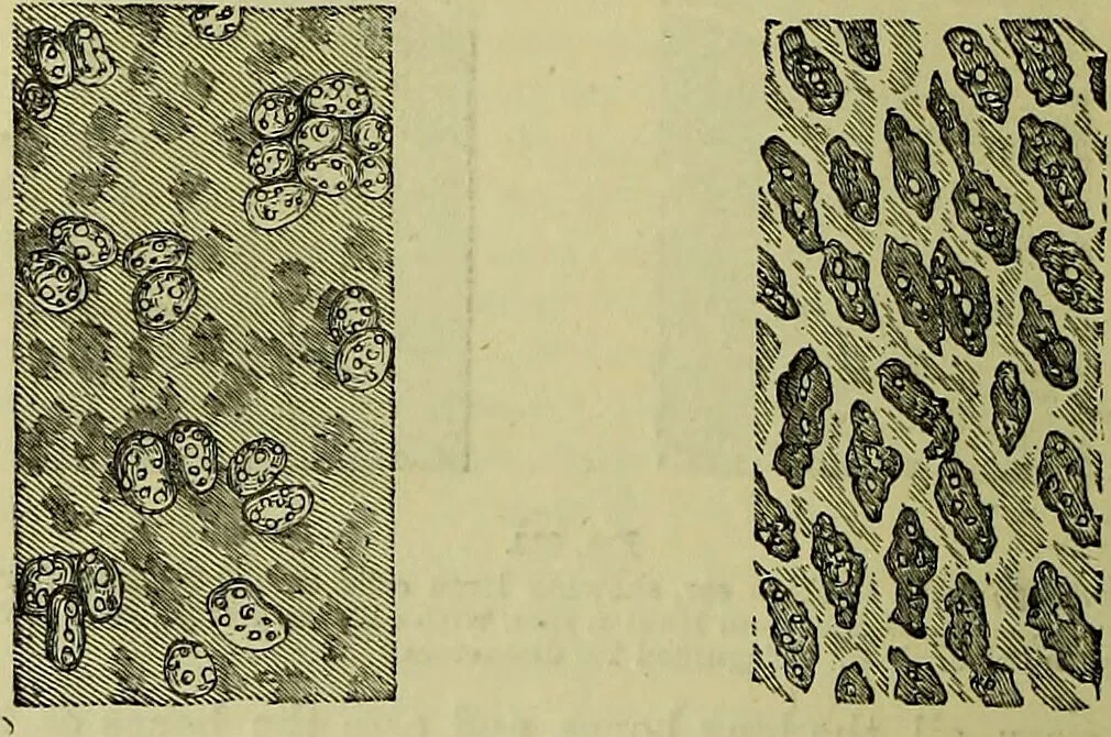 An illustration from The microscope : its history, construction, and application, being a familiar introduction to the use of the instrument, and the study of microscopical science / by Jabez Hogg ; with upwards of five hundred engravings, and coloured illustrations by Tuffen West., 1883, leaf 744