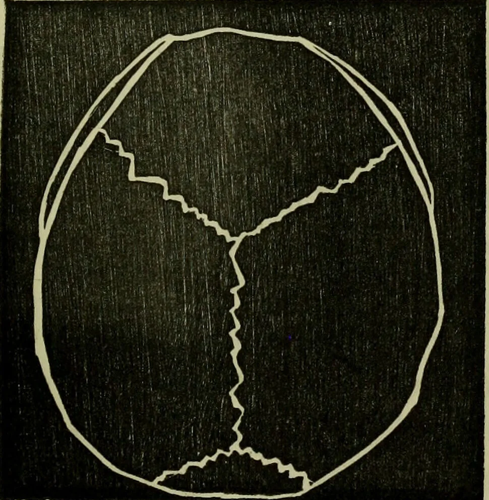 An illustration from Character, and its external signs., 1865, leaf 17