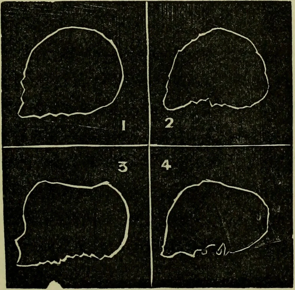 An illustration from Character, and its external signs., 1865, leaf 43