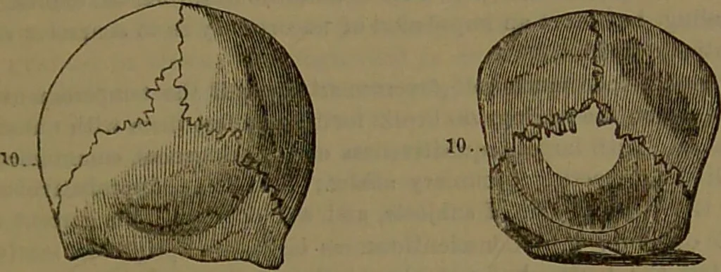 An illustration from New illustrated self-instructor in phrenology and physiology : with over one hundred engravings, together with the chart and character of ... as marked by ... / by O.S. and L.N. Fowler., 1852, leaf 107