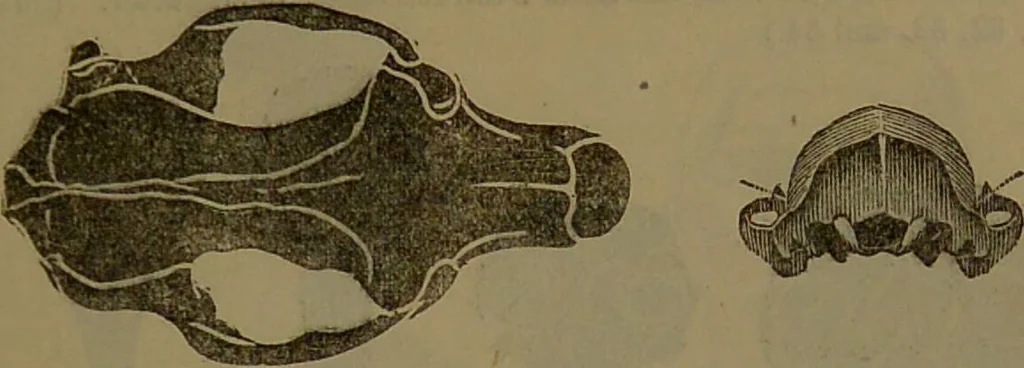 An illustration from New illustrated self-instructor in phrenology and physiology : with over one hundred engravings, together with the chart and character of ... as marked by ... / by O.S. and L.N. Fowler., 1852, leaf 67