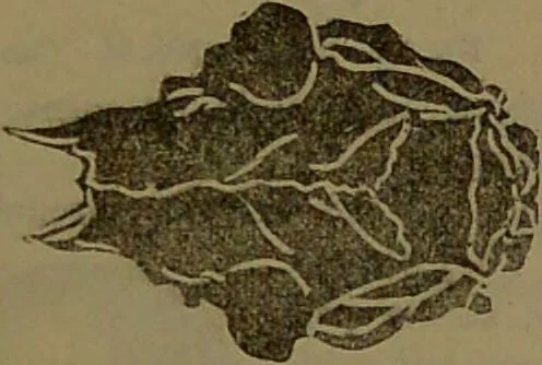 An illustration from New illustrated self-instructor in phrenology and physiology : with over one hundred engravings, together with the chart and character of ... as marked by ... / by O.S. and L.N. Fowler., 1852, leaf 67