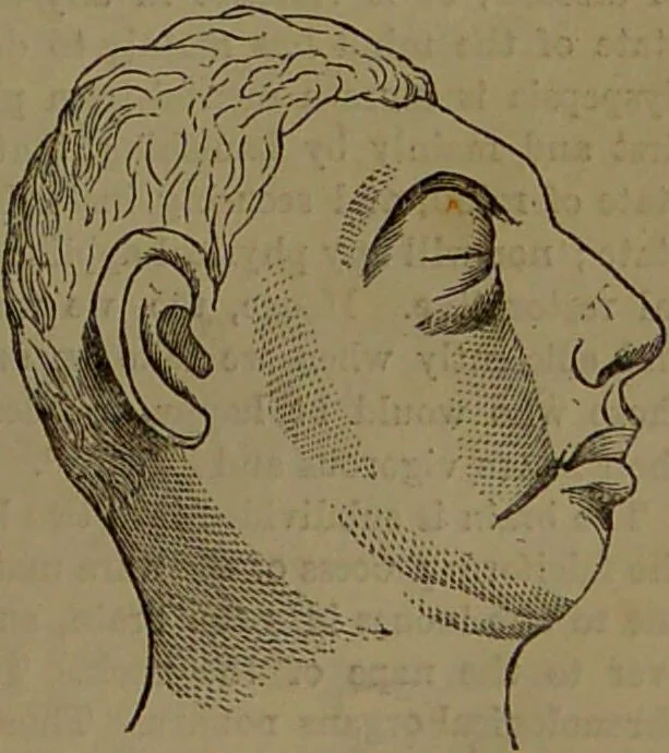 An illustration from New illustrated self-instructor in phrenology and physiology : with over one hundred engravings, together with the chart and character of ... as marked by ... / by O.S. and L.N. Fowler., 1852, leaf 69