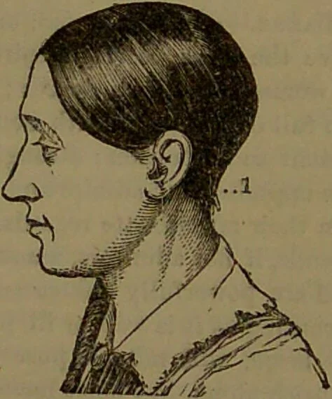 An illustration from New illustrated self-instructor in phrenology and physiology : with over one hundred engravings, together with the chart and character of ... as marked by ... / by O.S. and L.N. Fowler., 1852, leaf 79