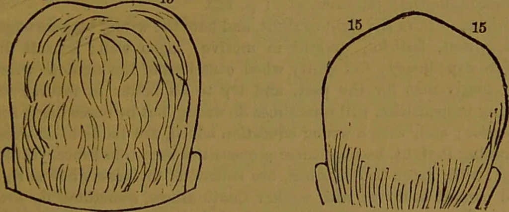 An illustration from New illustrated self-instructor in phrenology and physiology : with over one hundred engravings, together with the chart and character of ... as marked by ... / by O.S. and L.N. Fowler., 1864, leaf 121