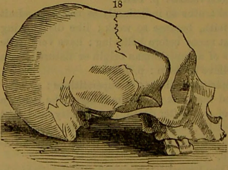 An illustration from New illustrated self-instructor in phrenology and physiology : with over one hundred engravings, together with the chart and character of ... as marked by ... / by O.S. and L.N. Fowler., 1864, leaf 128