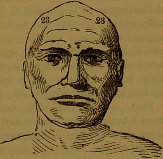 An illustration from New illustrated self-instructor in phrenology and physiology : with over one hundred engravings, together with the chart and character of ... as marked by ... / by O.S. and L.N. Fowler., 1864, leaf 141