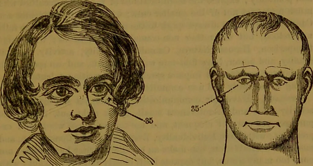An illustration from New illustrated self-instructor in phrenology and physiology : with over one hundred engravings, together with the chart and character of ... as marked by ... / by O.S. and L.N. Fowler., 1864, leaf 161