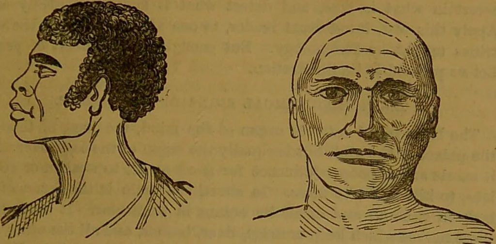 An illustration from New illustrated self-instructor in phrenology and physiology : with over one hundred engravings, together with the chart and character of ... as marked by ... / by O.S. and L.N. Fowler., 1864, leaf 69