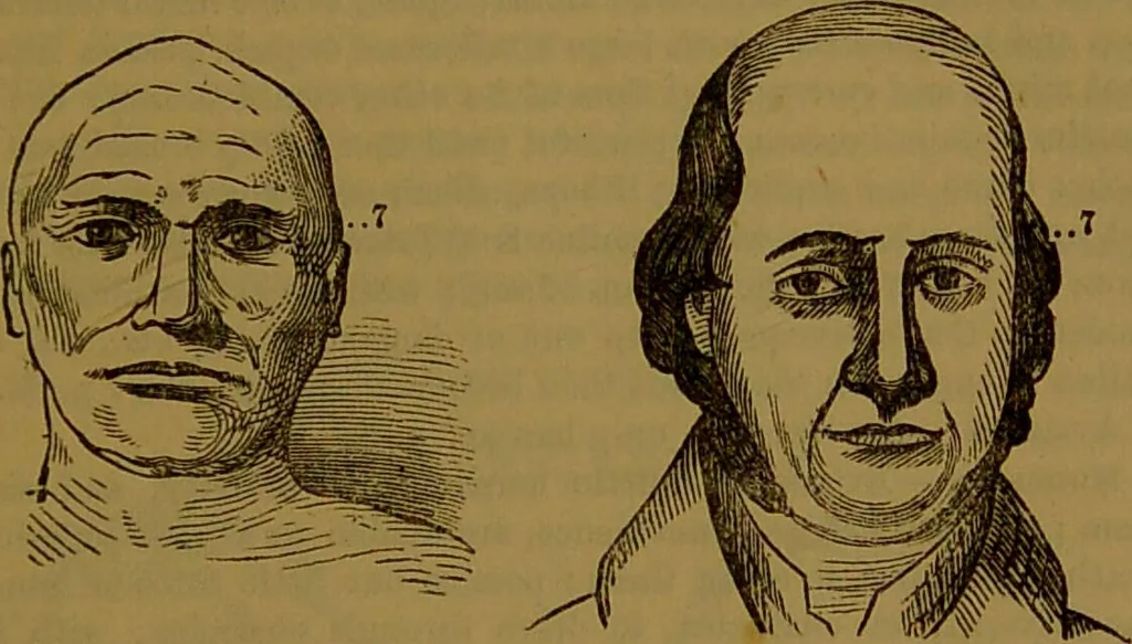 An illustration from New illustrated self-instructor in phrenology and physiology : with over one hundred engravings, together with the chart and character of ... as marked by ... / by O.S. and L.N. Fowler., 1864, leaf 99