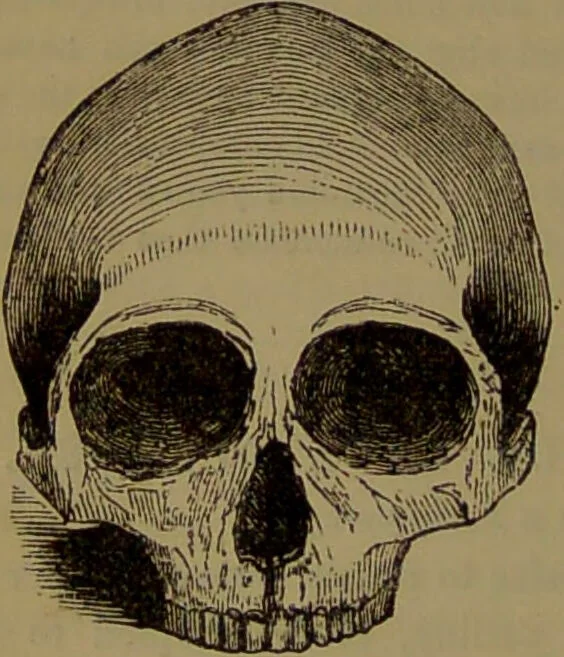 An illustration from New illustrated self-instructor in phrenology and physiology : with over one hundred engravings, together with the chart and character of ... as marked by ... / by O.S. and L.N. Fowler., 1872, leaf 104
