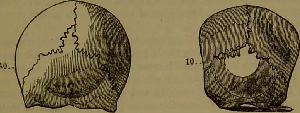 An illustration from New illustrated self-instructor in phrenology and physiology : with over one hundred engravings, together with the chart and character of ... as marked by ... / by O.S. and L.N. Fowler., 1872, leaf 107