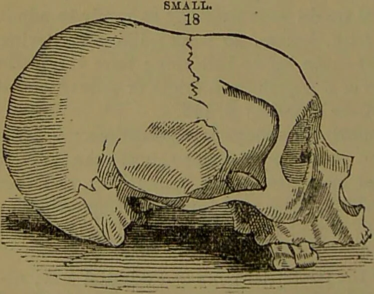 An illustration from New illustrated self-instructor in phrenology and physiology : with over one hundred engravings, together with the chart and character of ... as marked by ... / by O.S. and L.N. Fowler., 1872, leaf 128