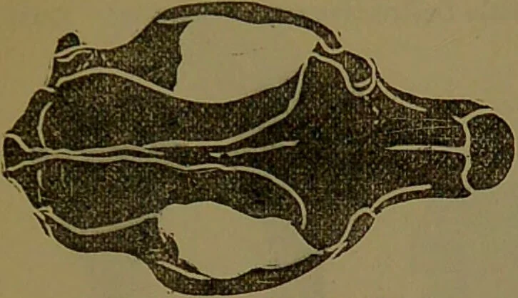 An illustration from New illustrated self-instructor in phrenology and physiology : with over one hundred engravings, together with the chart and character of ... as marked by ... / by O.S. and L.N. Fowler., 1872, leaf 67