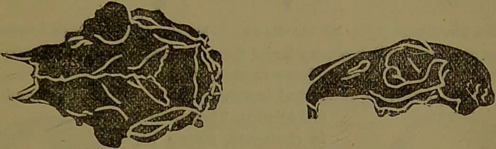 An illustration from New illustrated self-instructor in phrenology and physiology : with over one hundred engravings, together with the chart and character of ... as marked by ... / by O.S. and L.N. Fowler., 1872, leaf 67