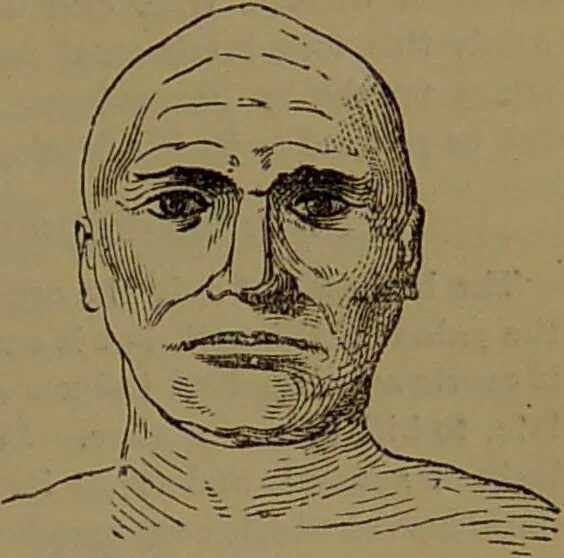 An illustration from New illustrated self-instructor in phrenology and physiology : with over one hundred engravings, together with the chart and character of ... as marked by ... / by O.S. and L.N. Fowler., 1872, leaf 69