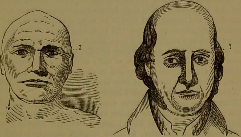 An illustration from New illustrated self-instructor in phrenology and physiology : with over one hundred engravings, together with the chart and character of ... as marked by ... / by O.S. and L.N. Fowler., 1872, leaf 99