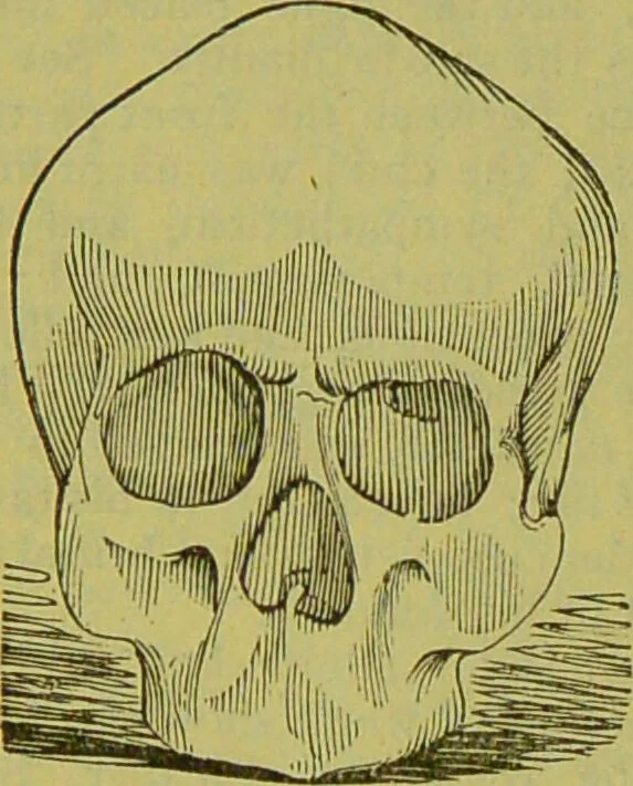 An illustration from How to study strangers by temperament, face and head : A sequel to "Heads and faces" / by Nelson Sizer., 1895, leaf 54